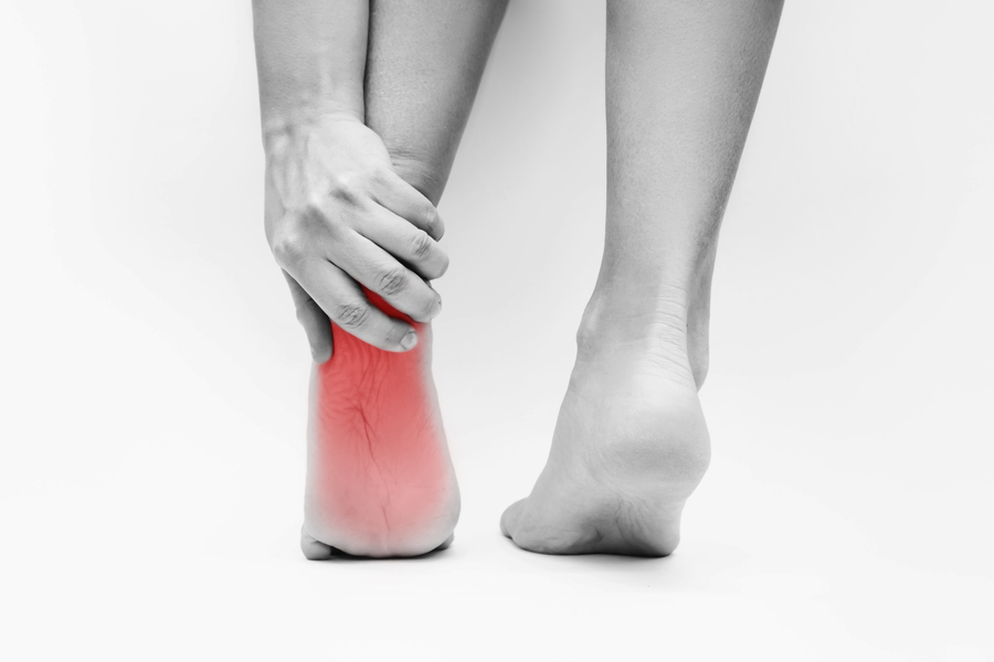 calcaneal spur