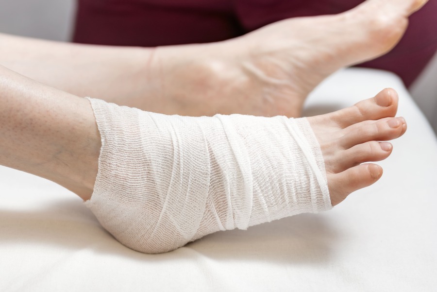 COLLE’S FRACTURE